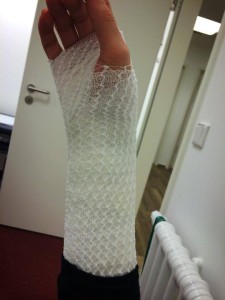 Nach der Attacke veröffentlichte Siegel auf Instagram und Facebook ein weiteres Bild, das ihren Arm nach medizinischer Versorgung zeigt